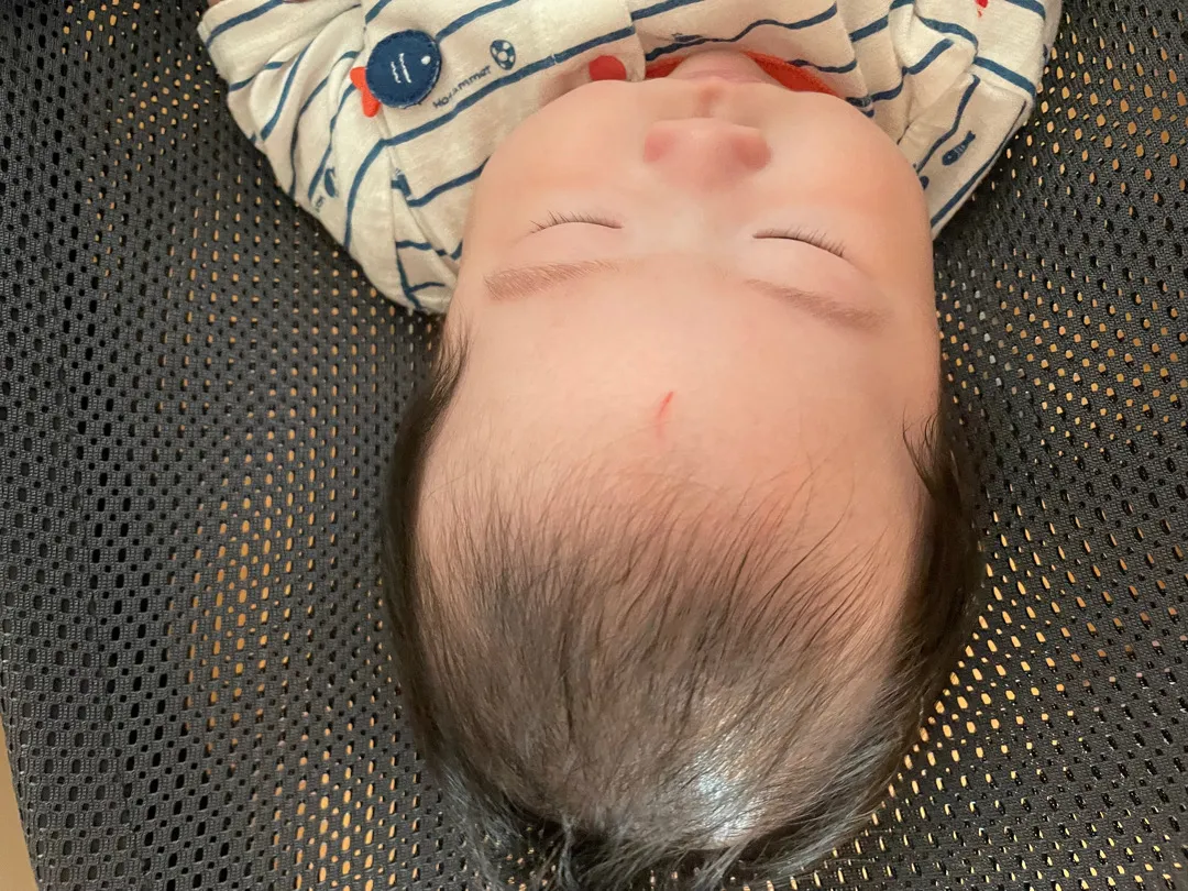 손톱 상처
