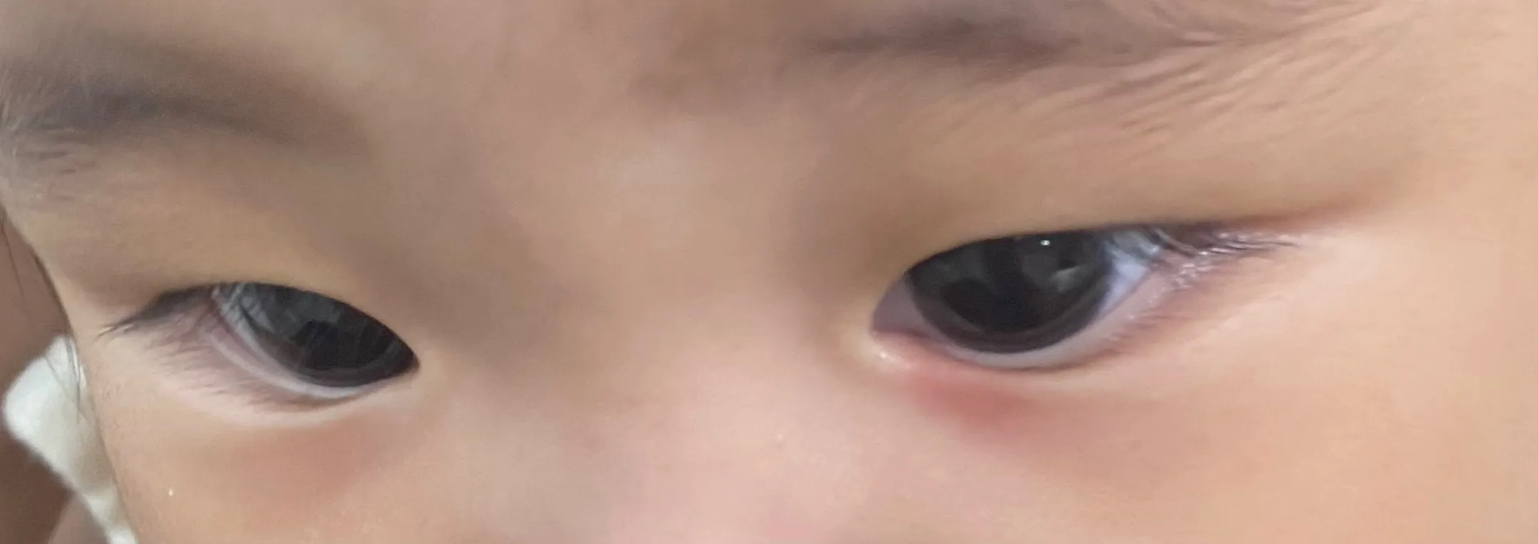 알러지 반응일까요ㅠ??