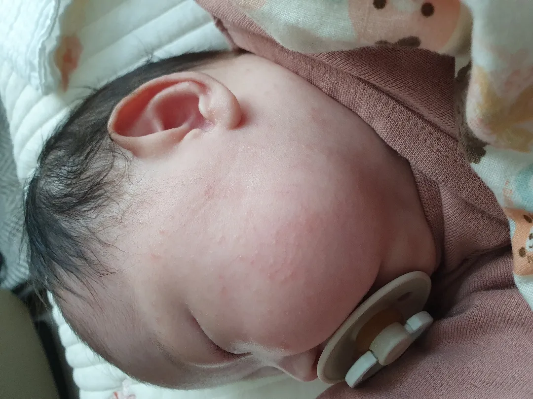 저도 피부좀 봐주세요