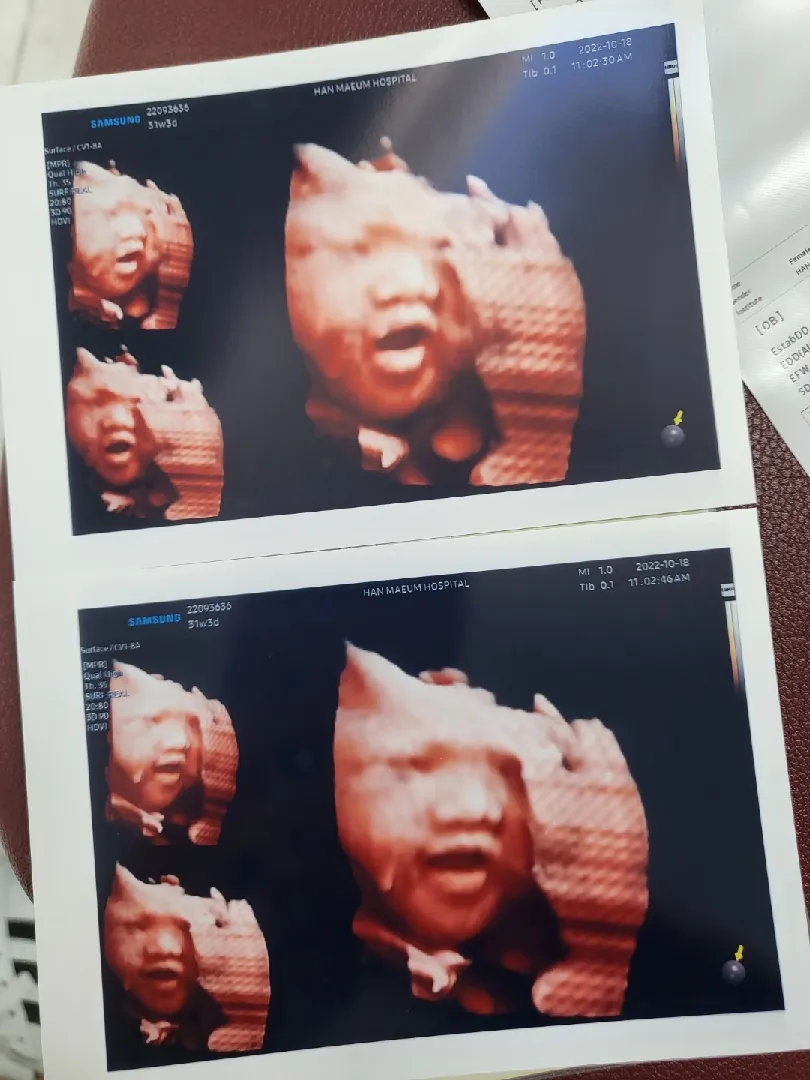 첫글!! 초음파 너무 귀여워서 올려봅니다
