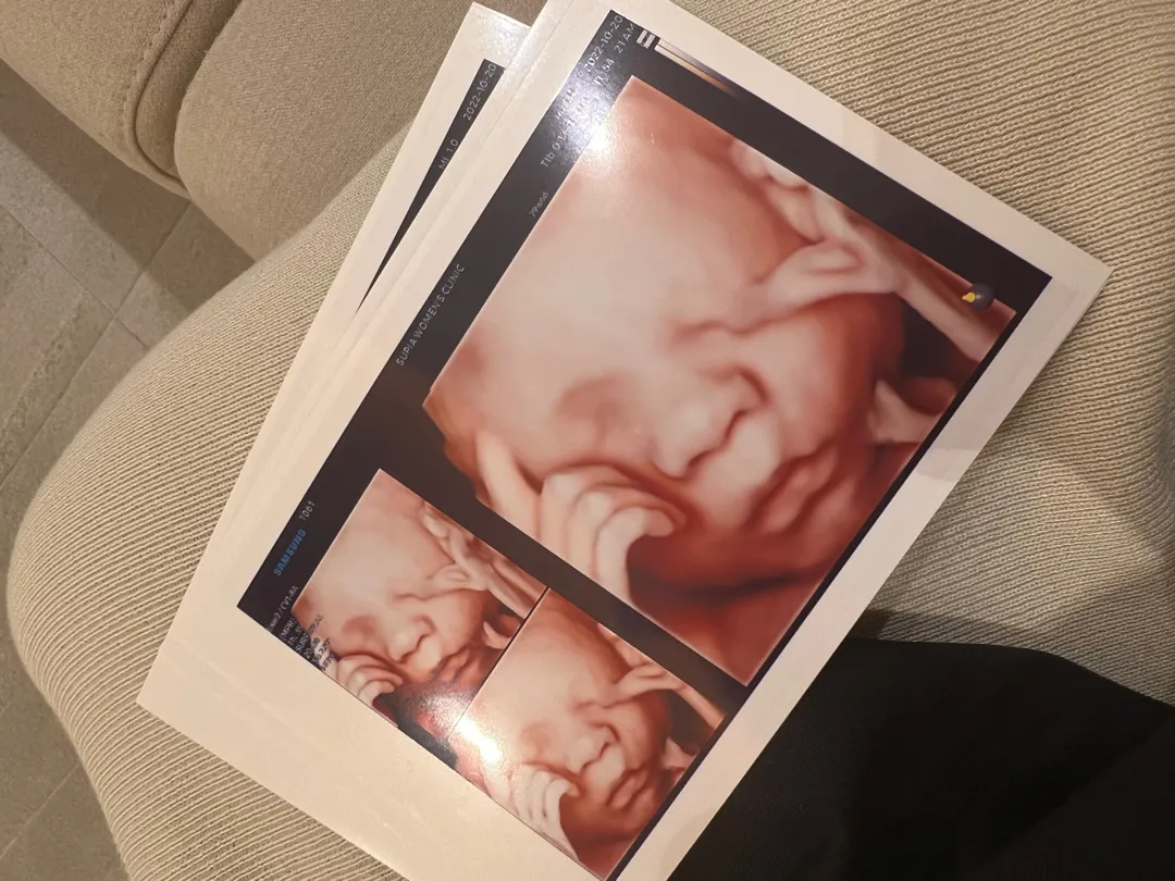 입체초음파 드디어 보고왔어요💕