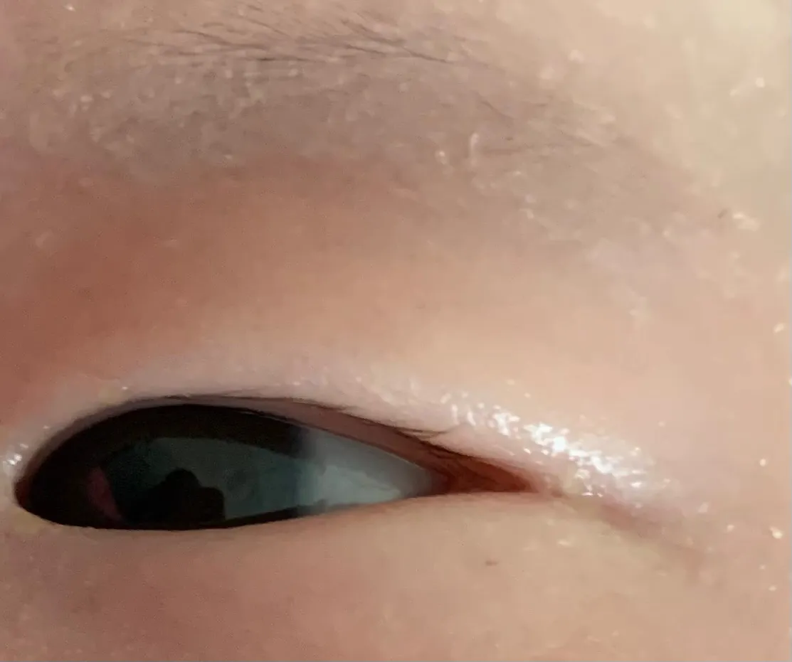 아기눈크기 변화