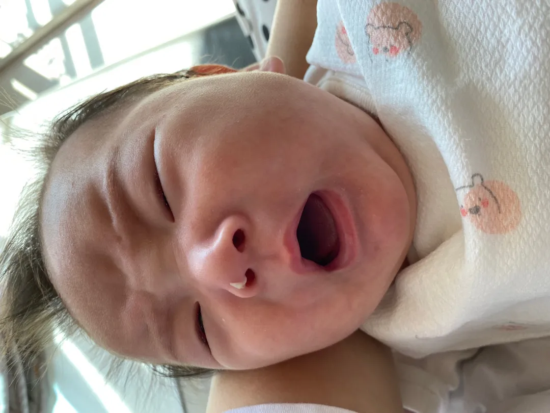 코딱지 코막힘
