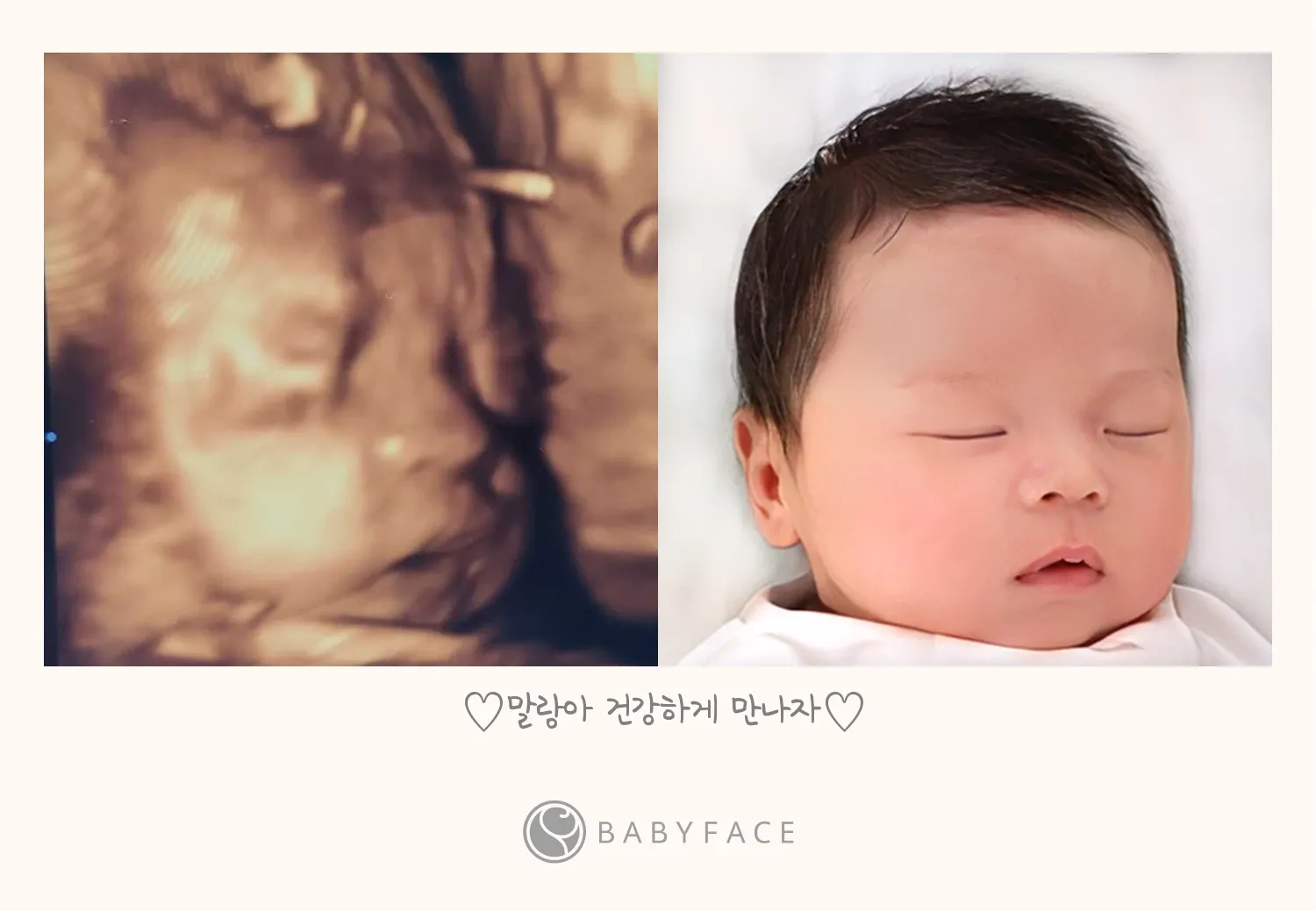 아기 얼굴이 너무 궁금한 나머지...