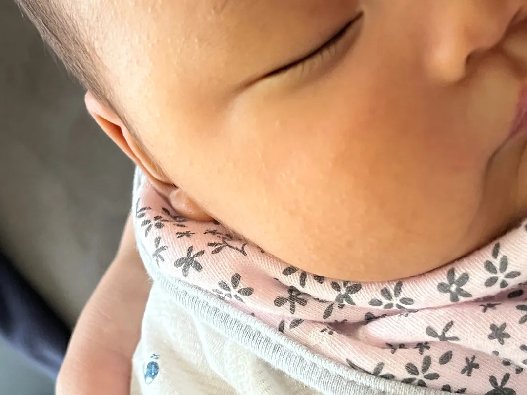아기피부에 이게 뭔지 봐주세요 ㅠㅠ