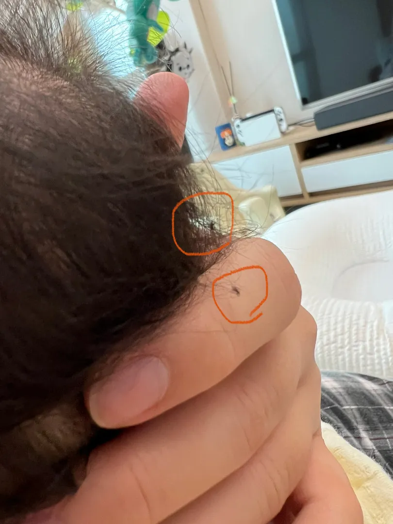 자고 일어나먼 머리가 엉키는 아기..
