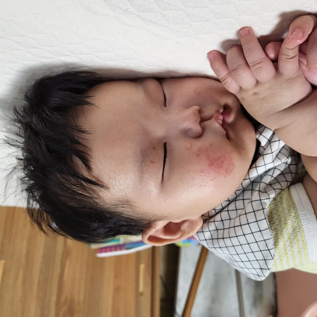 태열인지 봐주세요ㅠㅠ