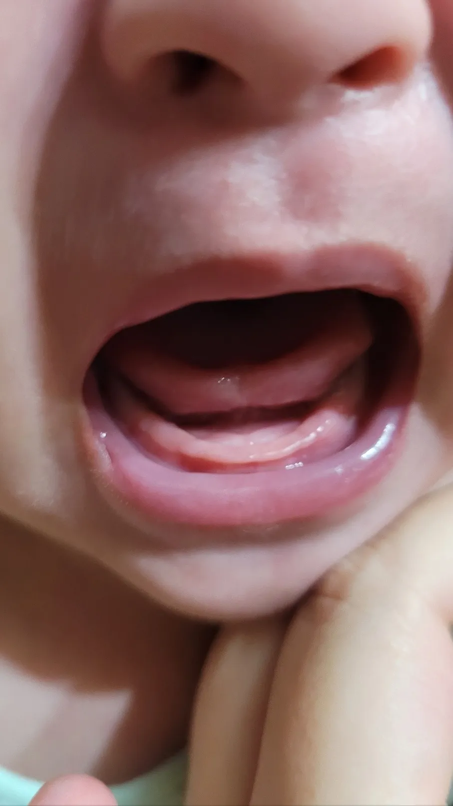 이앓이 일까요?