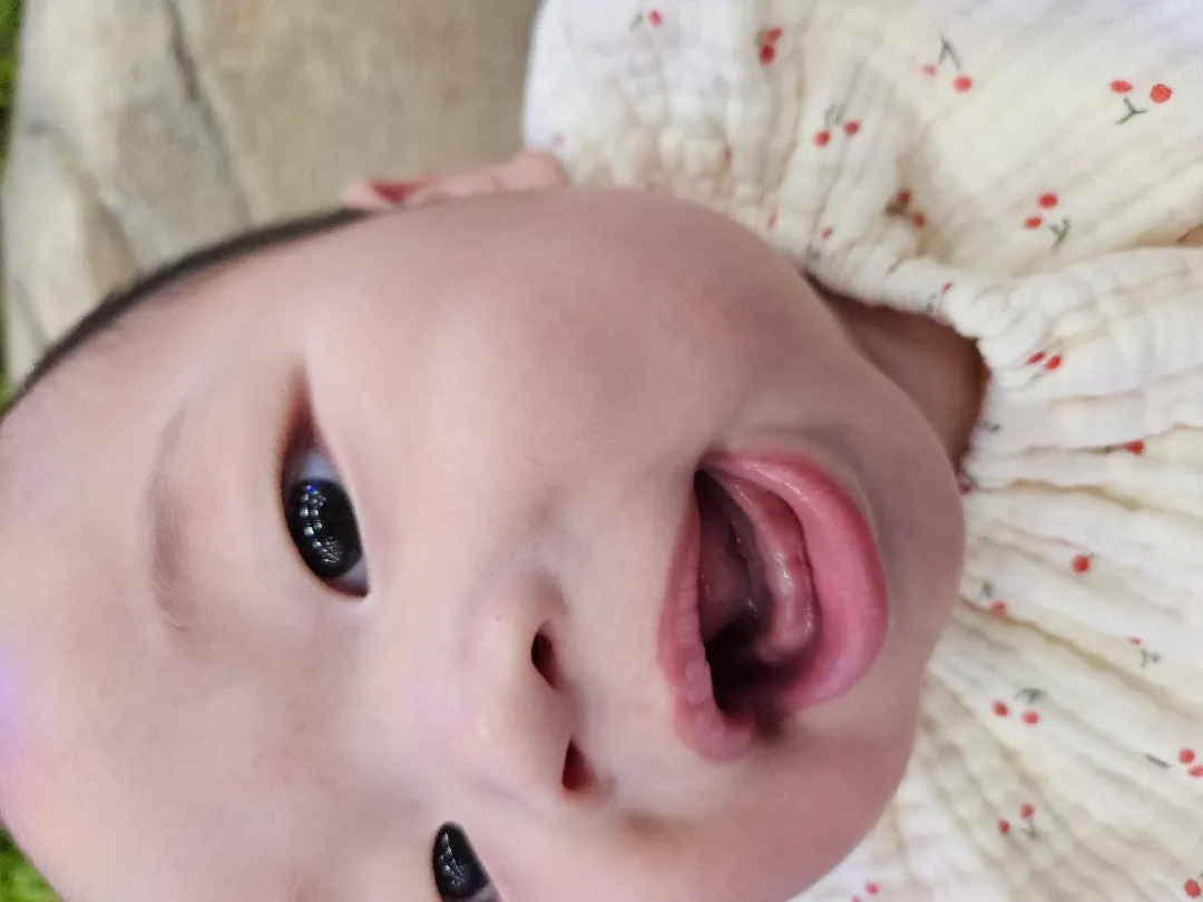 이앓이?