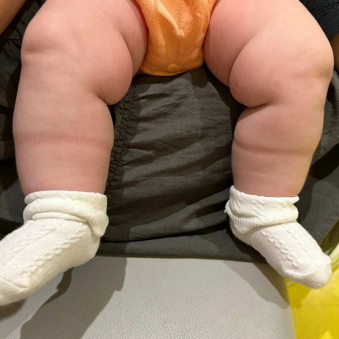 쏘세지팔과다리ㅎㅎㅎ울애기만이렁가..