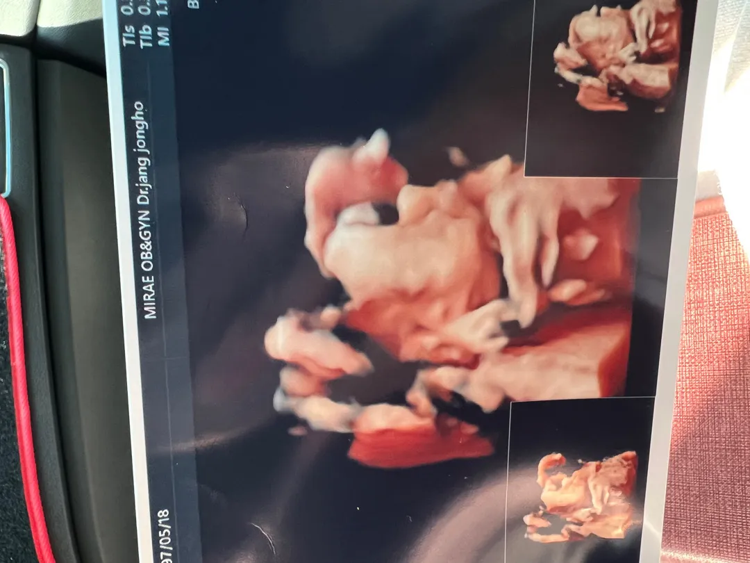 community post image