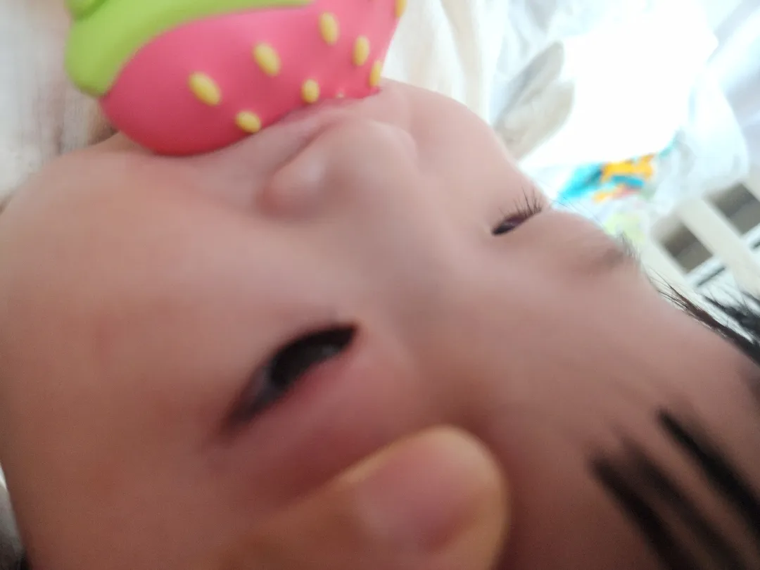 영아도 다래끼 생기나요?