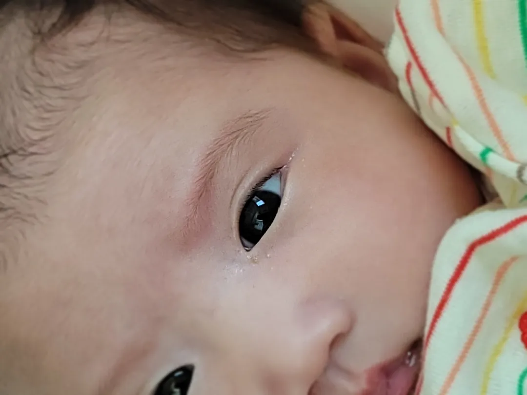 눈 밑 피부 좀 봐주세요