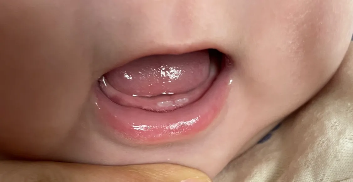 128일 이빨이 났습니다.....🦷