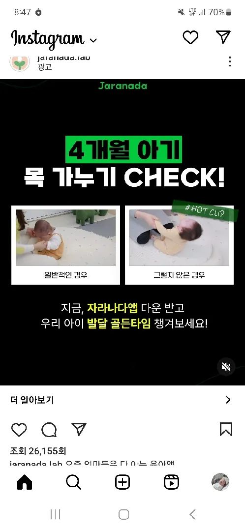 아기들 목 잘 가누나요~~?