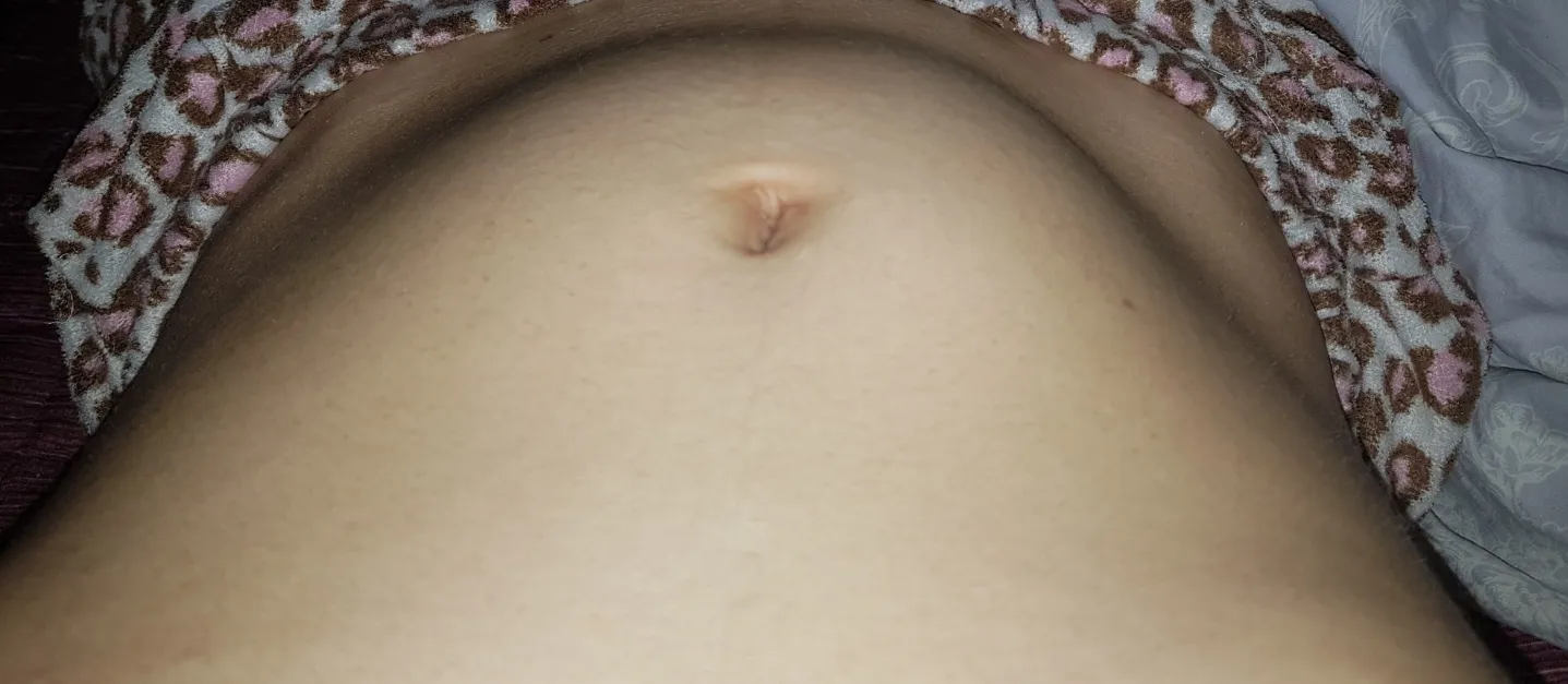 저와같은 증상있으신가요??