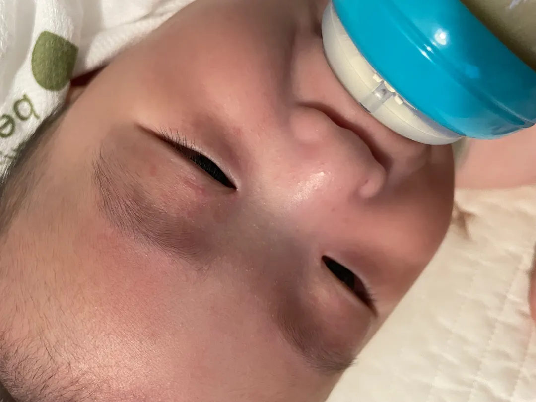 피부좀봐주세요