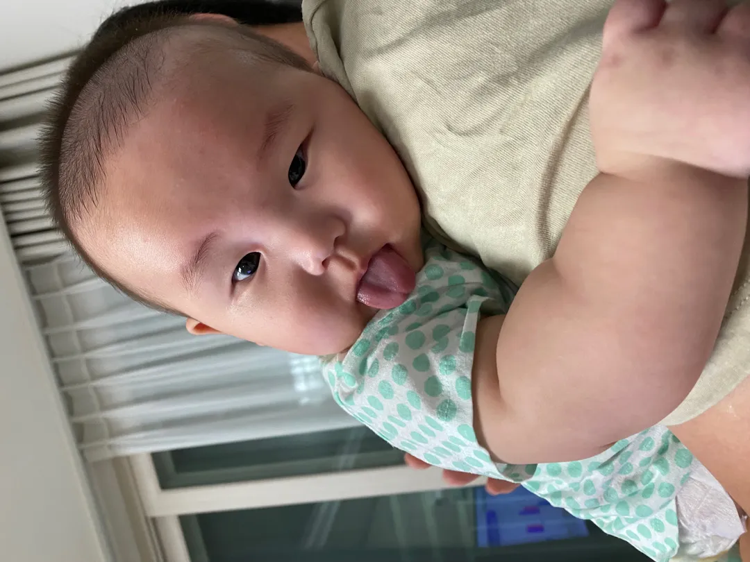 2차 영유아검진 후기(예약은 힘들어)