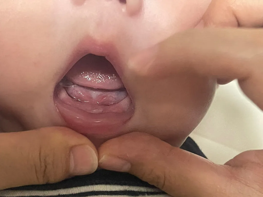 첫 치아가 생겼어요🤭