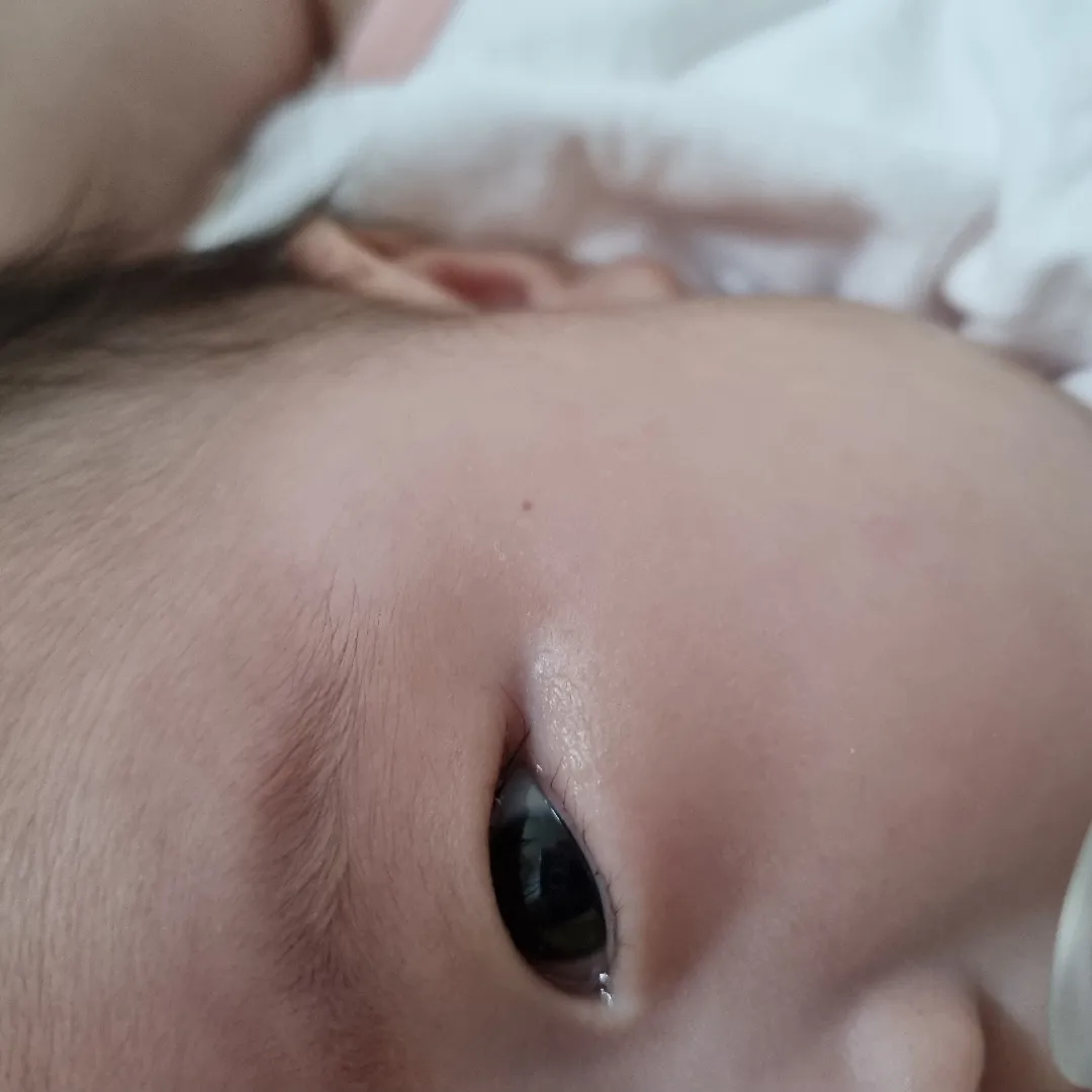 얼굴에 붉은점