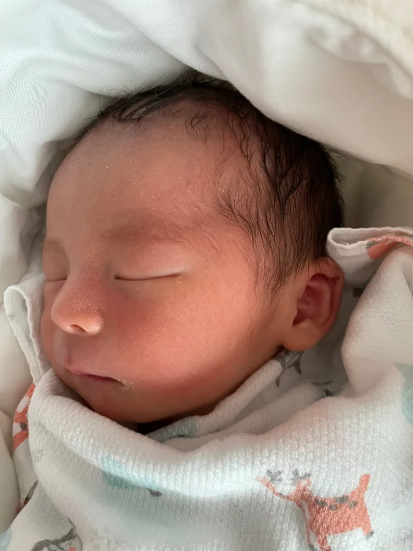 제왕절개 3일째 써보는 출산후기🧡