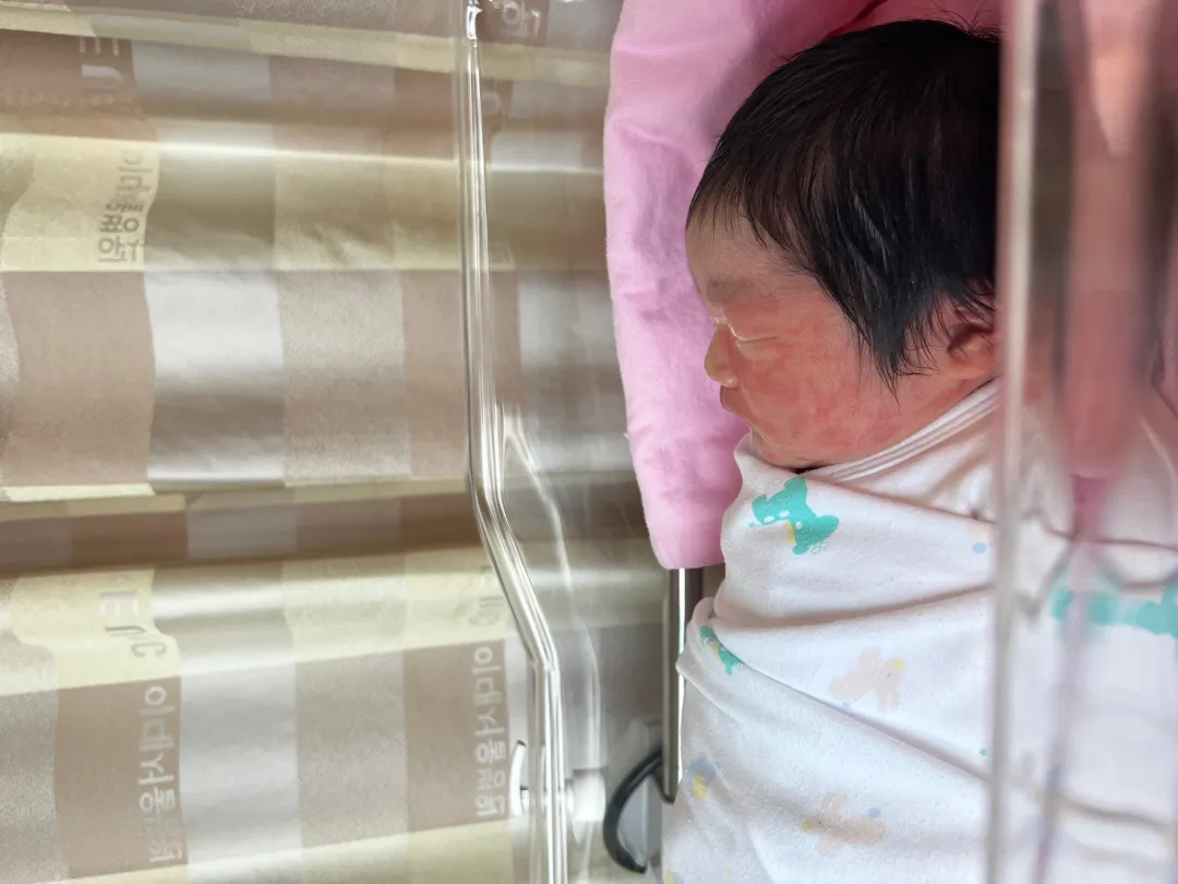 오늘 선택제왕으로 출산했어요! (아기피부 궁금증)