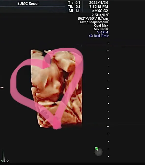 community post image