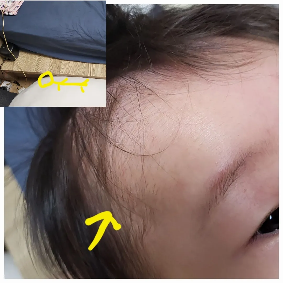 침대에서 낙상...