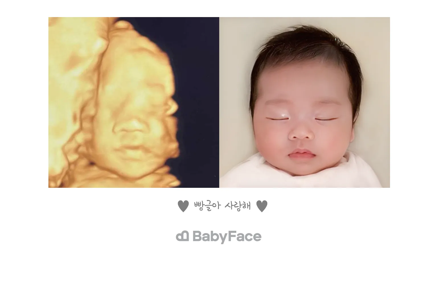 베이비페이스