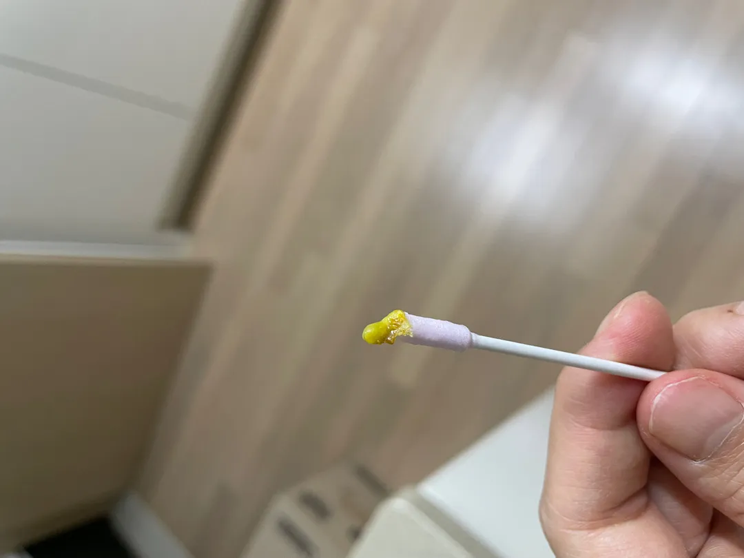 아기 감기인가요?
