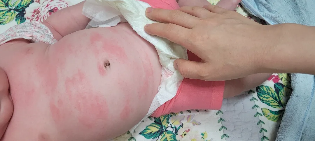 저희 아기같은 피부 있으신가요