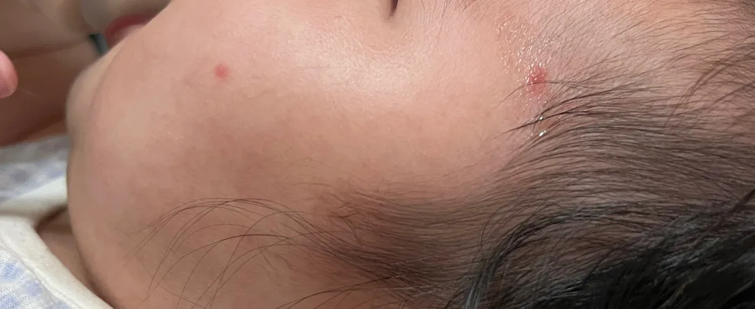 아침에 일어나니 이런게 생겼는데 뭘까요?