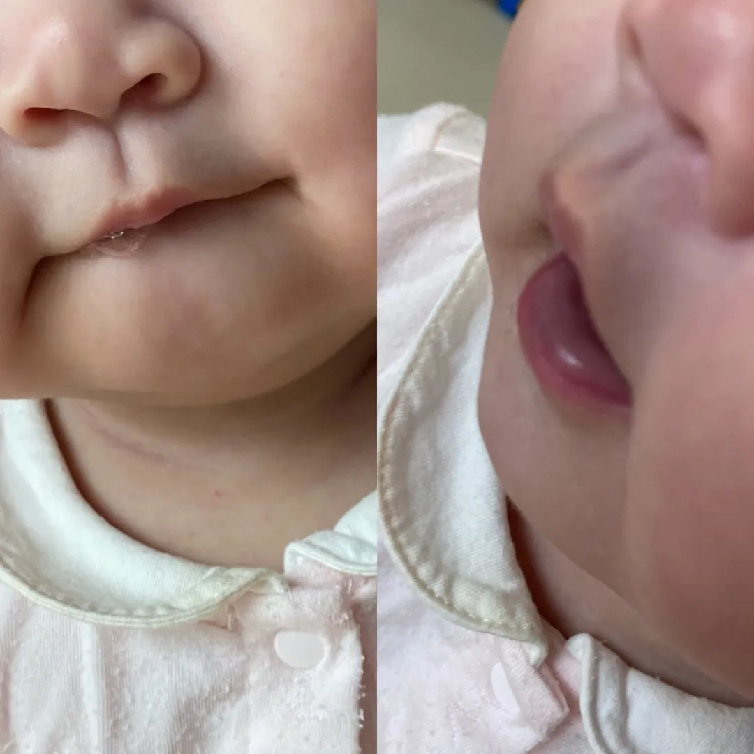 아랫입술 심하게 빠는 아기 있나요..?