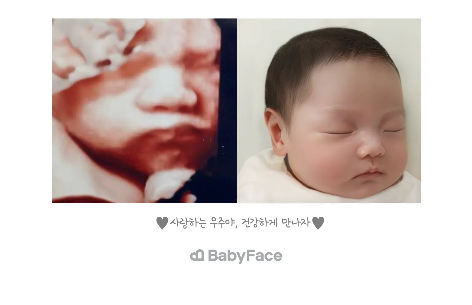 저도 베이비페이스 해봤어요 ㅎㅎ