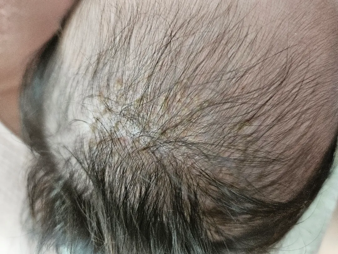 아기머리에 있는 노란껍질이 뭘까요?