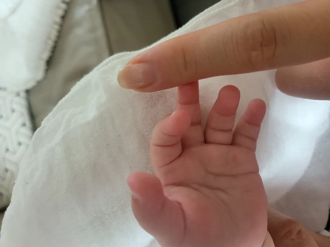 애기 손바닥줌 봐주세요