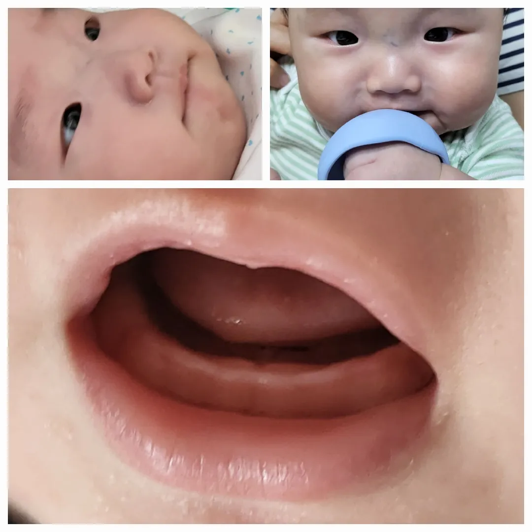 이것도 조만간 아랫니 난다는 신호인가요?