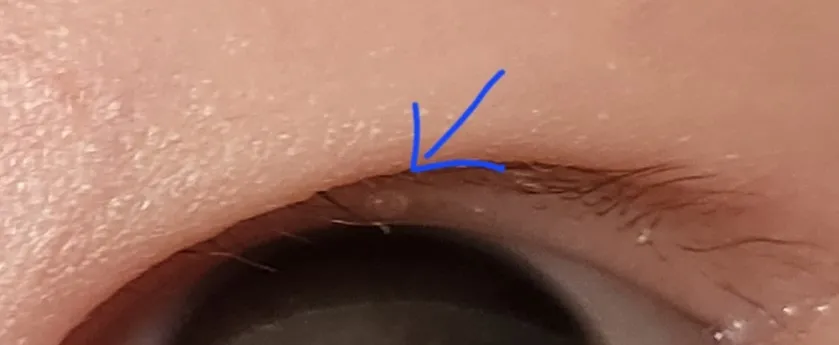 community post image