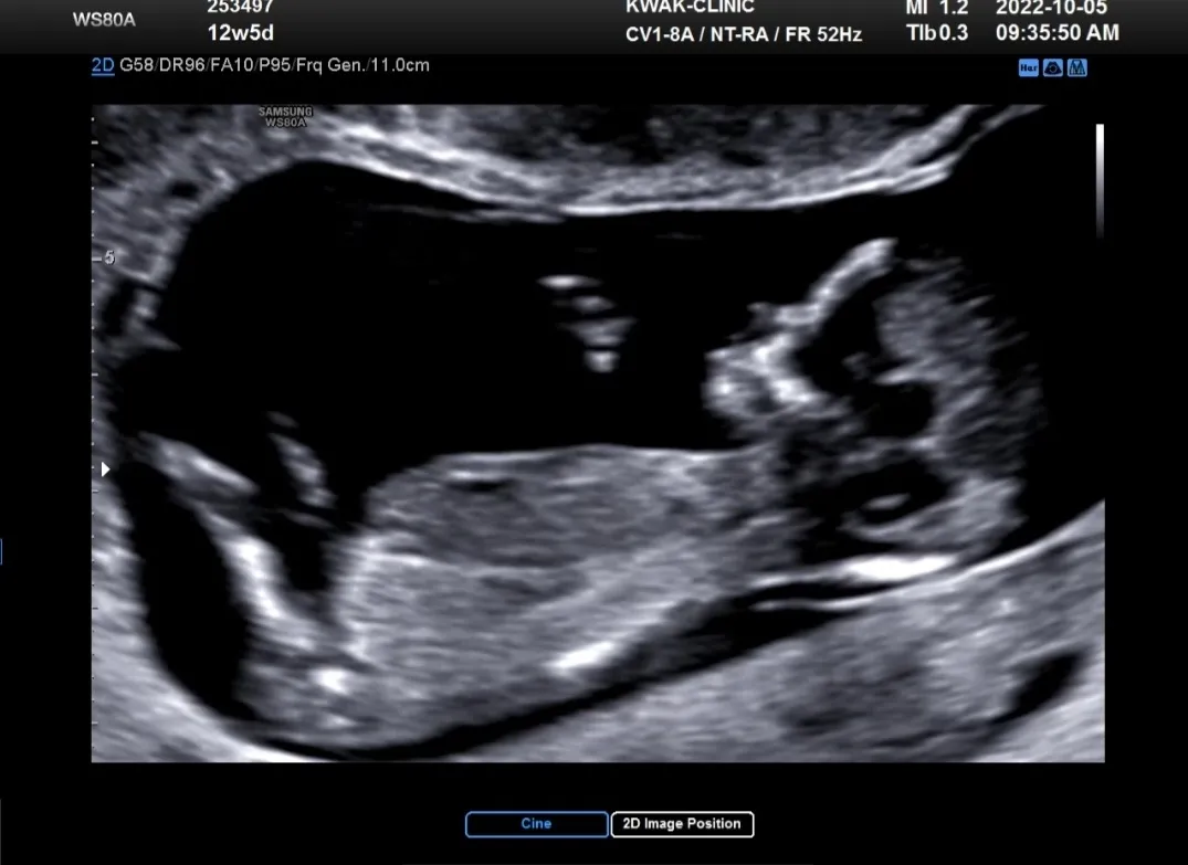 community post image
