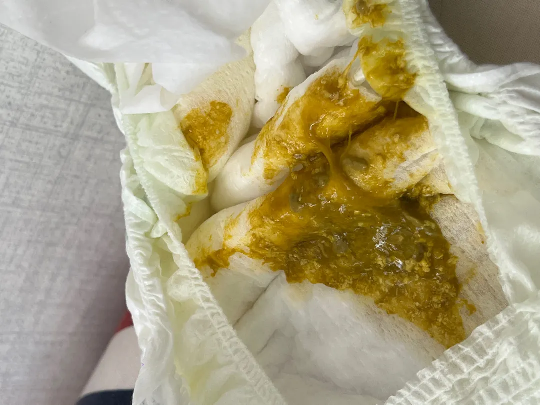 💩💩사진주의!! 응가상태를 좀 봐주세요🙏🏻