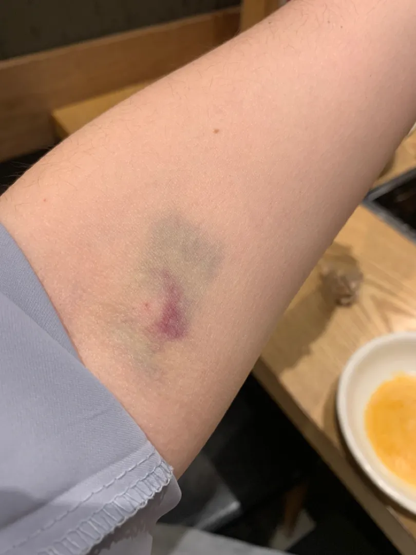 토요일 임당검사..결과 재검 확정