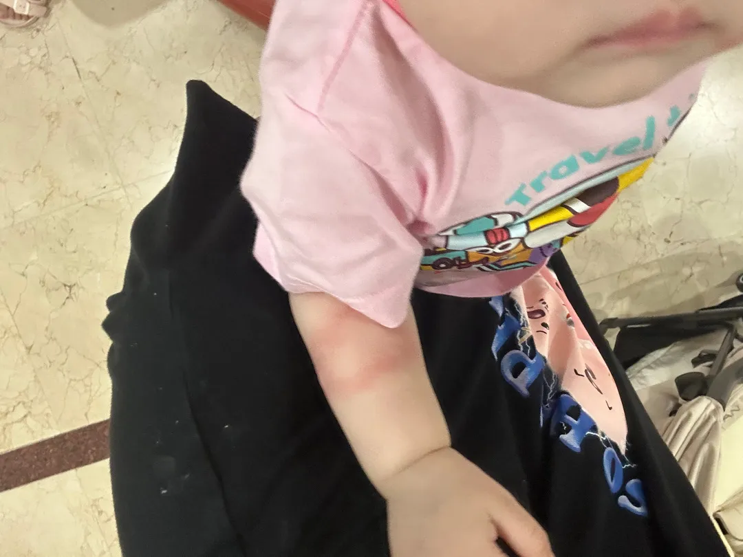 시판 이유식 알레르기