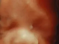 피부에 뭐가 난거 같은데 저건 뭘까요..?