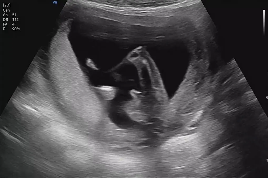 15w 5d 촘파🐰🤰🏻