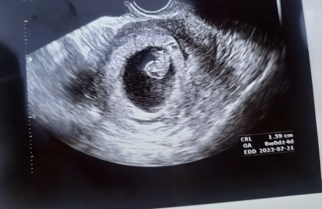무강이 8주차에요😆