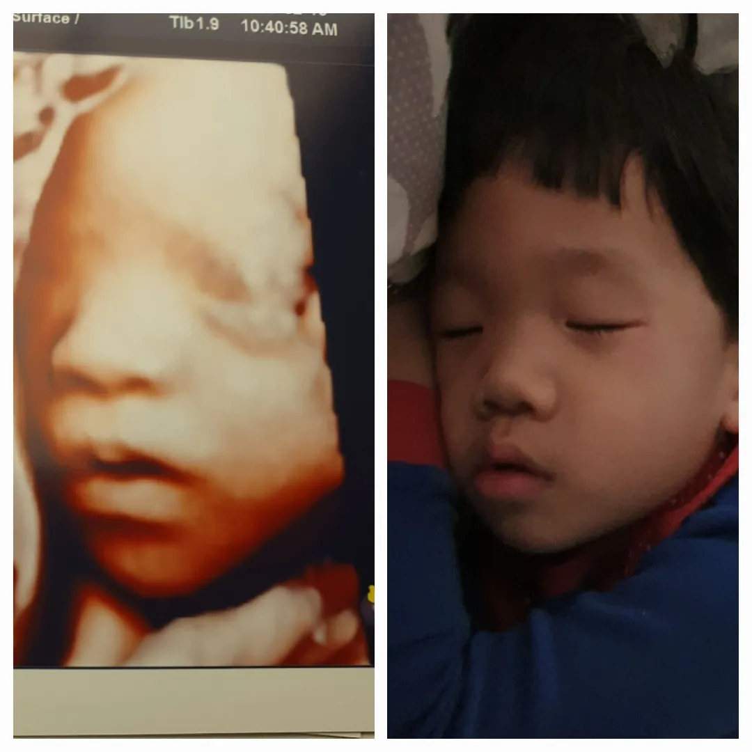 셋째 아들 초음파와 6살 둘째 아들  비교 사진^^