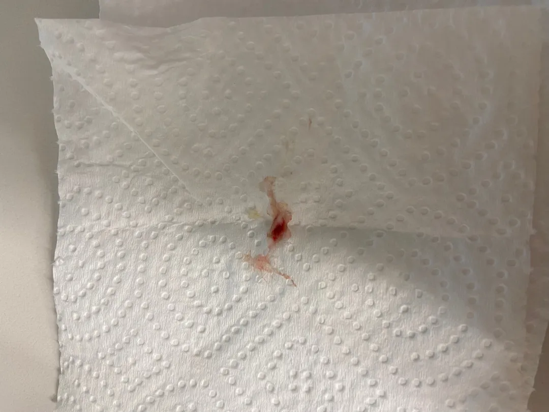 아기 코딱지 코피?ㅠㅠ사진좀봐주세요ㅠ