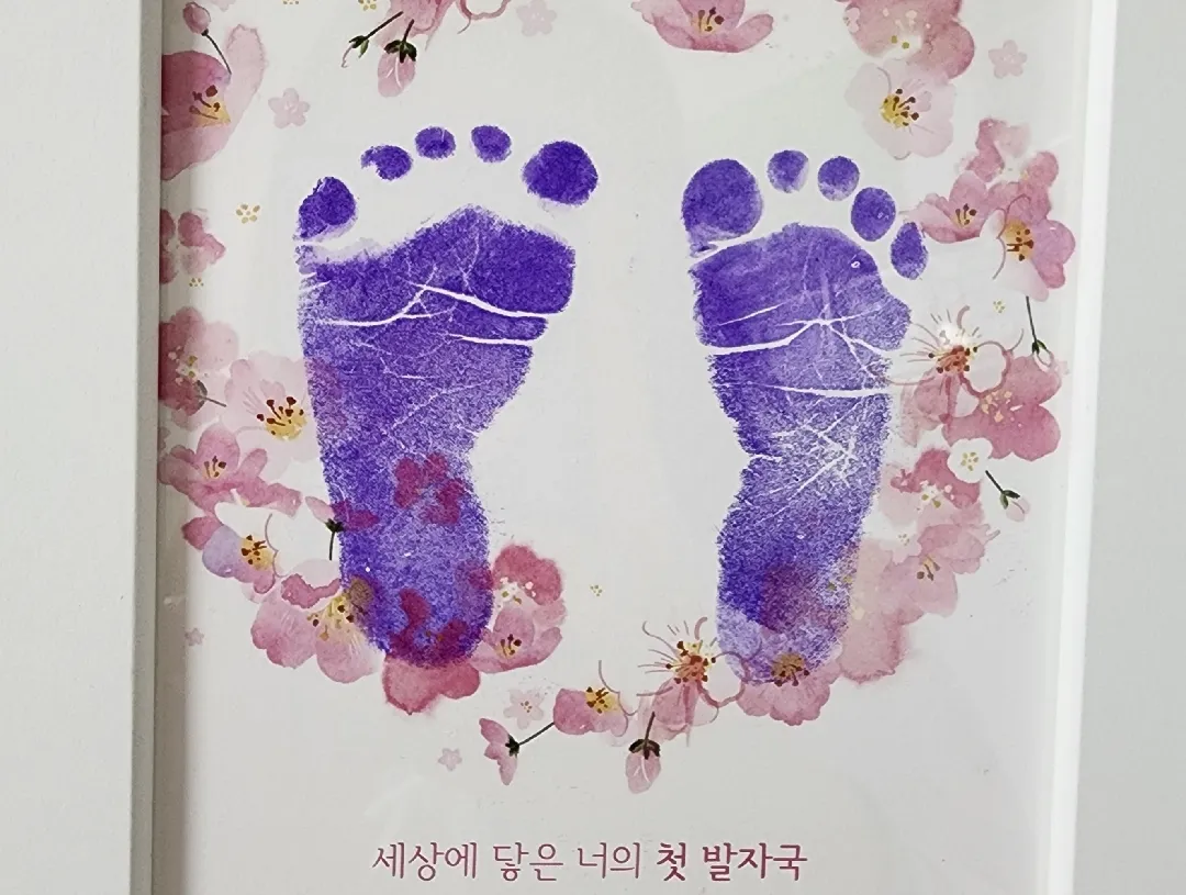 10년만의 임신, 38주4일 유도분만 성공! 우리 모두 힘내요!