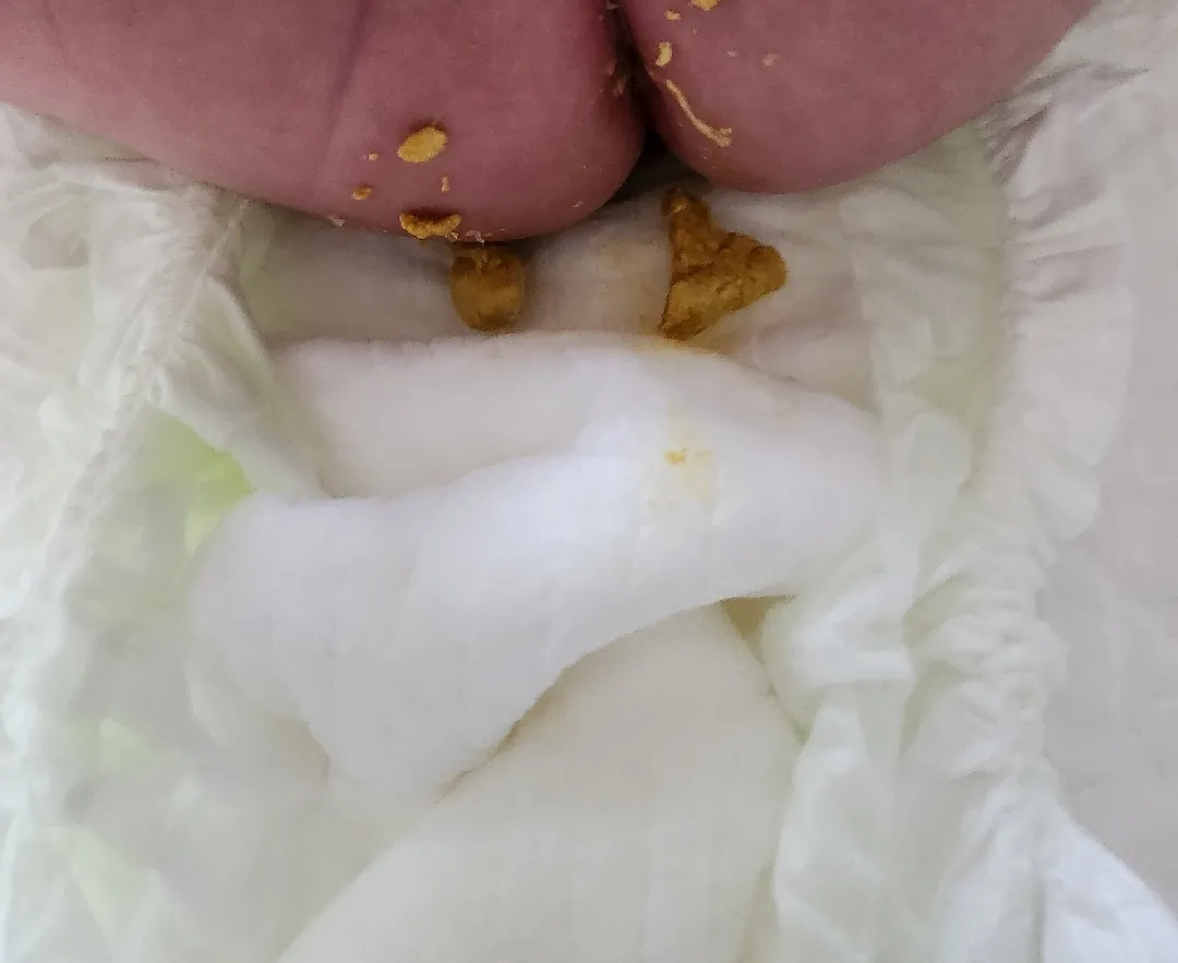 64일된 아기변 좀 봐주세요