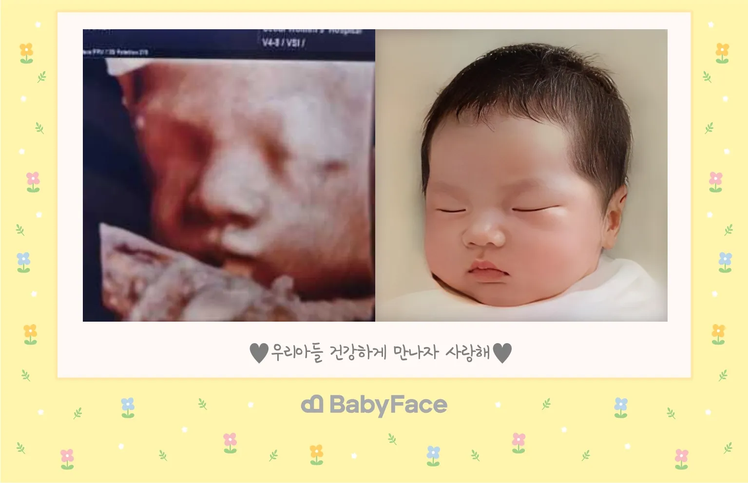 26주 입체촘파 베이비페이스